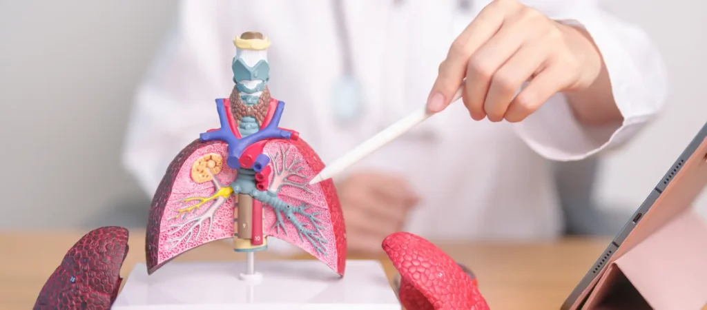 Radon exposure effect on health